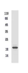 Human DMRTC1 protein, His tag. GTX117530-pro