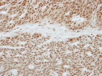 Anti-TOE1 antibody used in IHC (Paraffin sections) (IHC-P). GTX117545