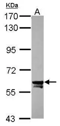 Anti-TOE1 antibody used in Western Blot (WB). GTX117545