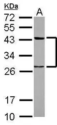 Anti-PTK9 antibody used in Western Blot (WB). GTX117546