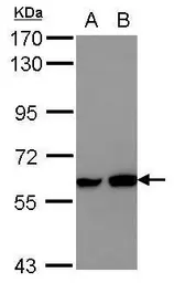Anti-MEF2D antibody used in Western Blot (WB). GTX117552