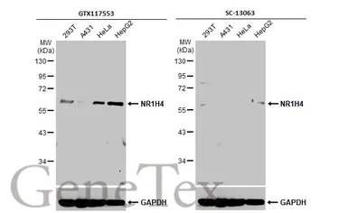 Anti-NR1H4 antibody used in Western Blot (WB). GTX117553