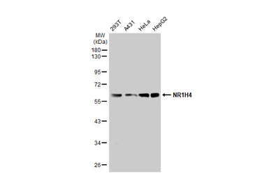 Anti-NR1H4 antibody used in Western Blot (WB). GTX117553