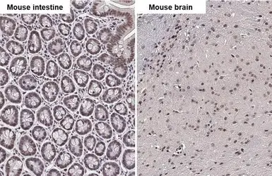 Anti-NR1H4 antibody used in IHC (Paraffin sections) (IHC-P). GTX117553