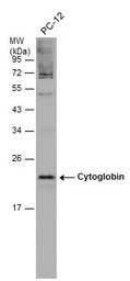Anti-Cytoglobin antibody used in Western Blot (WB). GTX117571