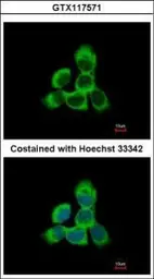 Anti-Cytoglobin antibody used in Immunocytochemistry/ Immunofluorescence (ICC/IF). GTX117571