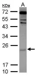 Anti-Cytoglobin antibody used in Western Blot (WB). GTX117571