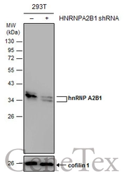 Anti-hnRNP A2B1 antibody used in Western Blot (WB). GTX117578