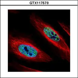 Anti-hnRNP A2B1 antibody used in Immunocytochemistry/ Immunofluorescence (ICC/IF). GTX117578