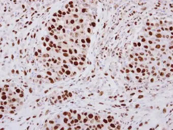 Anti-hnRNP A2B1 antibody used in IHC (Paraffin sections) (IHC-P). GTX117578