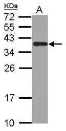 Anti-hnRNP A2B1 antibody used in Western Blot (WB). GTX117578
