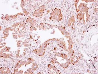 Anti-PLA2G4A antibody used in IHC (Paraffin sections) (IHC-P). GTX117583
