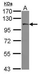 Anti-PLA2G4A antibody used in Western Blot (WB). GTX117583