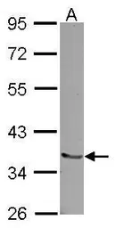Anti-Pirh2 antibody used in Western Blot (WB). GTX117588