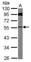 Anti-FBXL7 antibody used in Western Blot (WB). GTX117601