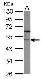 Anti-FBXL7 antibody used in Western Blot (WB). GTX117601