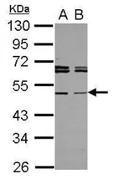 Anti-TAPBPL antibody [N2C3] used in Western Blot (WB). GTX117602