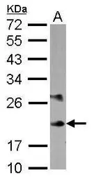 Anti-MLC1SA antibody [N1C3] used in Western Blot (WB). GTX117632
