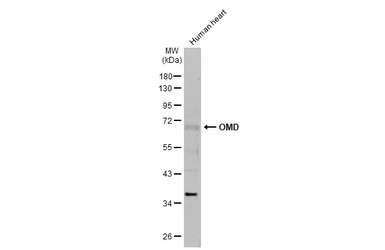 Anti-OMD antibody [N1C1] used in Western Blot (WB). GTX117635