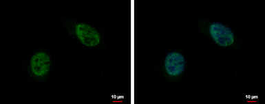 Anti-C10orf4 antibody used in Immunocytochemistry/ Immunofluorescence (ICC/IF). GTX117639