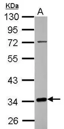 Anti-C10orf4 antibody used in Western Blot (WB). GTX117639