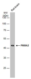 Anti-PNMA2 antibody used in Western Blot (WB). GTX117650