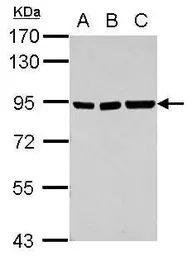 Anti-ZNF31 antibody [N3C1], Internal used in Western Blot (WB). GTX117653