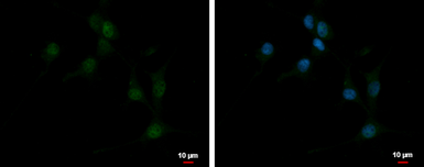 Anti-EBF3 antibody [C1C3] used in Immunocytochemistry/ Immunofluorescence (ICC/IF). GTX117656