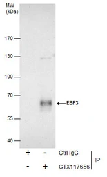 Anti-EBF3 antibody [C1C3] used in Immunoprecipitation (IP). GTX117656