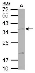 Anti-NOTCH2NL antibody [N2C3] used in Western Blot (WB). GTX117659