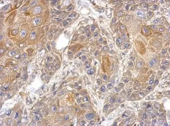 Anti-RAPGEFL1 antibody [C2C3], C-term used in IHC (Paraffin sections) (IHC-P). GTX117673