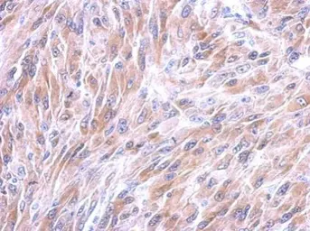 Anti-Galectin 8 antibody used in IHC (Paraffin sections) (IHC-P). GTX117687