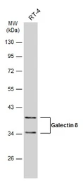 Anti-Galectin 8 antibody used in Western Blot (WB). GTX117687