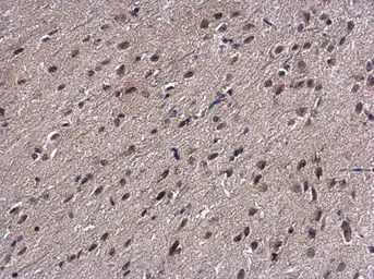 Anti-Proteasome 20S beta 7 antibody [N2C3] used in IHC (Paraffin sections) (IHC-P). GTX117690