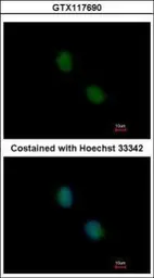 Anti-Proteasome 20S beta 7 antibody [N2C3] used in Immunocytochemistry/ Immunofluorescence (ICC/IF). GTX117690