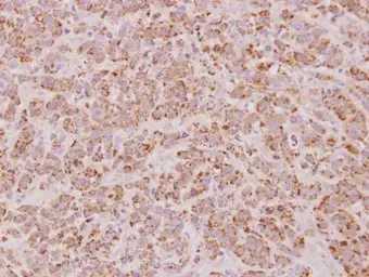 Anti-Proteasome 20S beta 7 antibody [N2C3] used in IHC (Paraffin sections) (IHC-P). GTX117690
