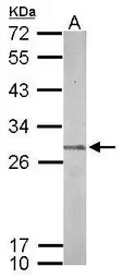 Anti-Proteasome 20S beta 7 antibody [N2C3] used in Western Blot (WB). GTX117690
