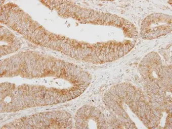 Anti-SERPINA12 antibody [N2C3] used in IHC (Paraffin sections) (IHC-P). GTX117695