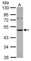 Anti-SERPINA12 antibody [N2C3] used in Western Blot (WB). GTX117695