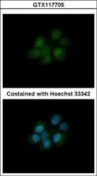 Anti-DHFR antibody used in Immunocytochemistry/ Immunofluorescence (ICC/IF). GTX117705