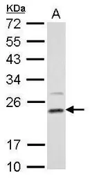 Anti-DHFR antibody used in Western Blot (WB). GTX117705