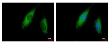 Anti-ABCE1 antibody used in Immunocytochemistry/ Immunofluorescence (ICC/IF). GTX117706
