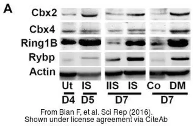 Anti-CBX2 antibody used in Western Blot (WB). GTX117711