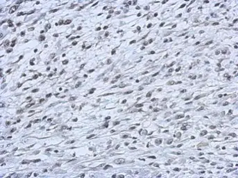 Anti-CBX2 antibody used in IHC (Paraffin sections) (IHC-P). GTX117711