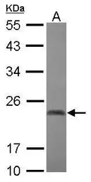 Anti-CBX2 antibody used in Western Blot (WB). GTX117711