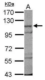 Anti-CPSF2 antibody [C1C3] used in Western Blot (WB). GTX117729