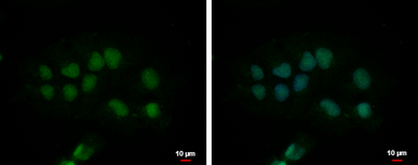Anti-CPSF2 antibody [N1N3] used in Immunocytochemistry/ Immunofluorescence (ICC/IF). GTX117730