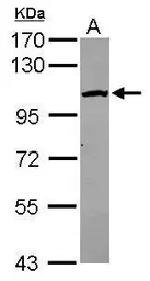 Anti-CPSF2 antibody [N1N3] used in Western Blot (WB). GTX117730