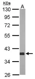 Anti-AKR1D1 antibody [N3C3] used in Western Blot (WB). GTX117738
