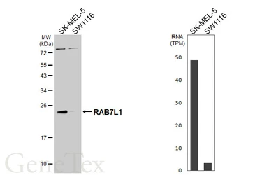 Anti-RAB7L1 antibody [N1C3-2] used in Western Blot (WB). GTX117740